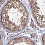 TTC23 Antibody in Immunohistochemistry (IHC)