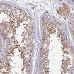 MYO9A Polyclonal Antibody