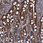 WWC3 Antibody in Immunohistochemistry (Paraffin) (IHC (P))
