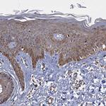 WWC3 Antibody in Immunohistochemistry (Paraffin) (IHC (P))