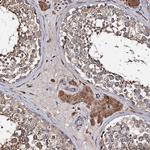 WWC3 Antibody in Immunohistochemistry (Paraffin) (IHC (P))