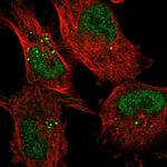 KDELC2 Antibody in Immunocytochemistry (ICC/IF)
