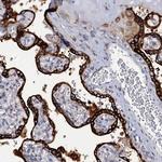 KDELC2 Antibody in Immunohistochemistry (Paraffin) (IHC (P))