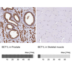 BET1L Antibody in Immunohistochemistry (Paraffin) (IHC (P))