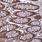 RTRAF Antibody in Immunohistochemistry (Paraffin) (IHC (P))
