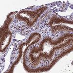 RTRAF Antibody in Immunohistochemistry (Paraffin) (IHC (P))
