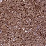RTRAF Antibody in Immunohistochemistry (Paraffin) (IHC (P))