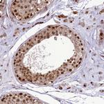 RTRAF Antibody in Immunohistochemistry (Paraffin) (IHC (P))