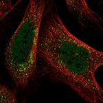 PIGQ Polyclonal Antibody