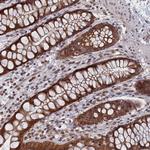 PIGQ Antibody in Immunohistochemistry (Paraffin) (IHC (P))