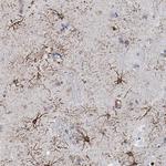 RIN3 Antibody in Immunohistochemistry (Paraffin) (IHC (P))