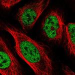 PPP4R2 Polyclonal Antibody