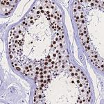 PPP4R2 Antibody in Immunohistochemistry (Paraffin) (IHC (P))