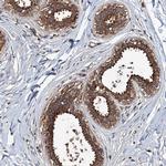 ZN438 Antibody in Immunohistochemistry (Paraffin) (IHC (P))