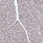 WHSC2 Antibody in Immunohistochemistry (Paraffin) (IHC (P))