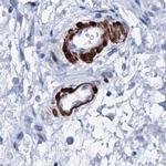 NRIP2 Antibody in Immunohistochemistry (IHC)
