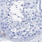 NRIP2 Antibody in Immunohistochemistry (IHC)