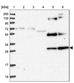 NRIP2 Antibody in Western Blot (WB)