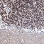 NRIP2 Antibody in Immunohistochemistry (IHC)