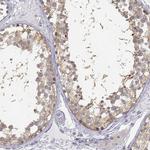 GLIPR1L2 Antibody in Immunohistochemistry (IHC)