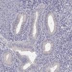 GLIPR1L2 Antibody in Immunohistochemistry (IHC)