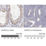 GLIPR1L2 Antibody