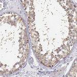 GLIPR1L2 Antibody in Immunohistochemistry (IHC)
