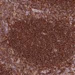 SIPA1 Antibody in Immunohistochemistry (Paraffin) (IHC (P))
