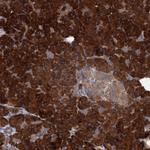 ALKBH7 Polyclonal Antibody