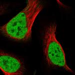 SECISBP2L Polyclonal Antibody