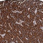 SECISBP2L Antibody in Immunohistochemistry (IHC)