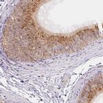 NXPE2 Antibody in Immunohistochemistry (IHC)