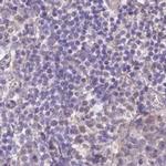 NXPE2 Antibody in Immunohistochemistry (IHC)