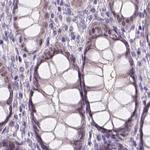 NXPE2 Antibody in Immunohistochemistry (IHC)