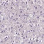 NXPE2 Antibody in Immunohistochemistry (IHC)