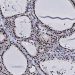 CWC15 Antibody in Immunohistochemistry (Paraffin) (IHC (P))
