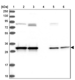 CWC15 Antibody in Western Blot (WB)