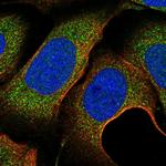 C11orf57 Polyclonal Antibody