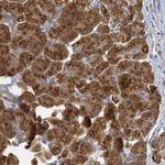 C11orf57 Antibody in Immunohistochemistry (Paraffin) (IHC (P))