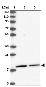 C11orf57 Antibody in Western Blot (WB)
