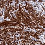 ZDHHC16 Antibody in Immunohistochemistry (Paraffin) (IHC (P))