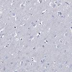 TMEM72 Polyclonal Antibody