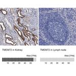 TMEM72 Antibody in Immunohistochemistry (IHC)
