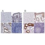 TMEM72 Antibody in Immunohistochemistry (IHC)