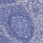 TMEM72 Antibody in Immunohistochemistry (IHC)