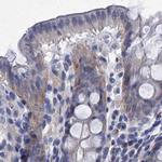 TMEM72 Antibody in Immunohistochemistry (IHC)