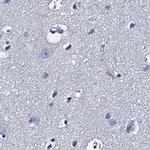 TMEM72 Antibody in Immunohistochemistry (IHC)