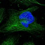 CFAP54 Polyclonal Antibody