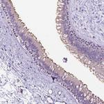 CFAP54 Antibody in Immunohistochemistry (Paraffin) (IHC (P))