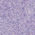 CFAP54 Antibody in Immunohistochemistry (Paraffin) (IHC (P))